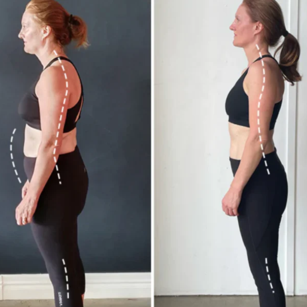 Correcteur de Posture – Réglable – Sangles Croisées