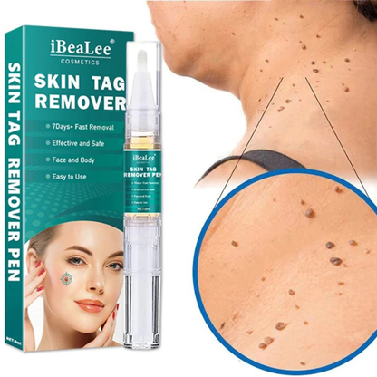 SkinFix Éliminateur de Verrues et de Taches | Retrait Rapide et Doux