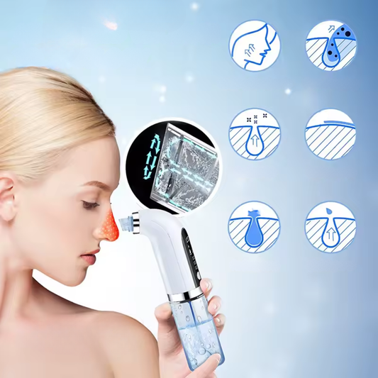 Aspirateur Points Noirs – Aspiration Réglable – Rechargeable USB