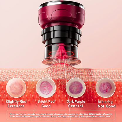 Masseur Ventouse Chauffant Intelligent