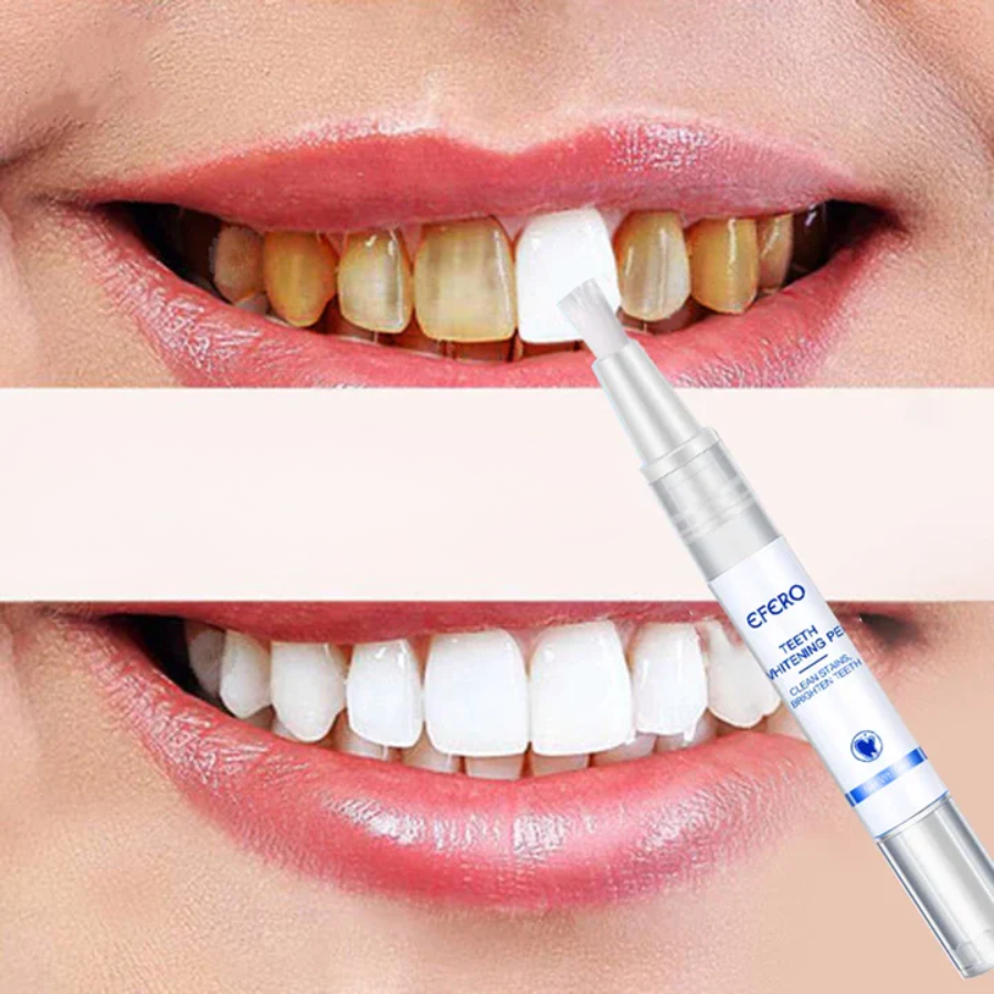 UltraSmile Stylo Blanchissant | Élimination Instantanée des Taches