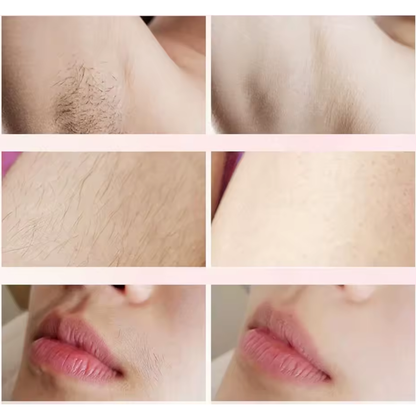 Épilateur Électrique Femme – Rechargeable USB – Double Tête