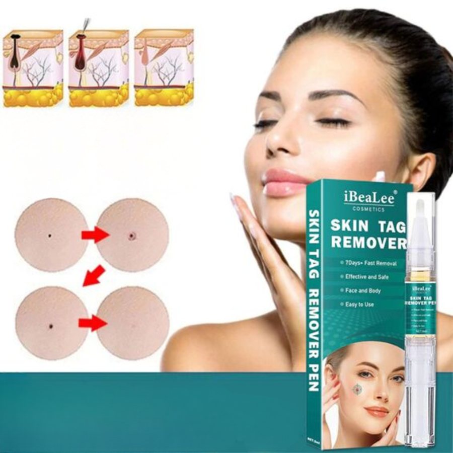 SkinFix Éliminateur de Verrues et de Taches | Retrait Rapide et Doux