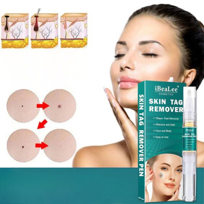 SkinFix Éliminateur de Verrues et de Taches | Retrait Rapide et Doux