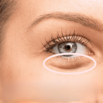 EyeGlow Rejuvenating Red Light Therapy | Des yeux radieux et une réduction des rides et ridules